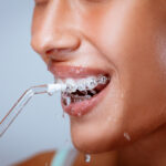 Burnos priežiūra žmonėms su breketais ar dantų implantais